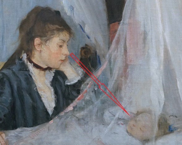 Diagonal view and connection of restlessness and tenderness
